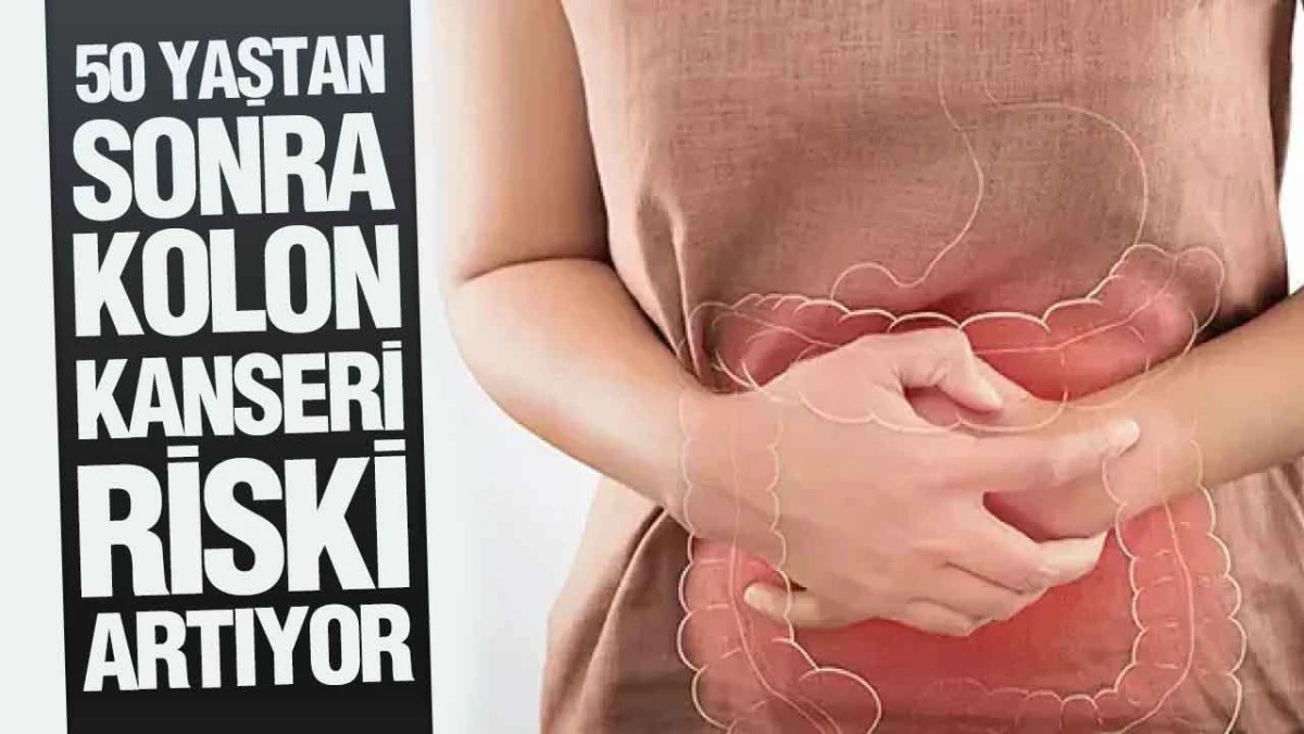 50 Yaştan Sonra Kolon Kanseri Riski Artıyor