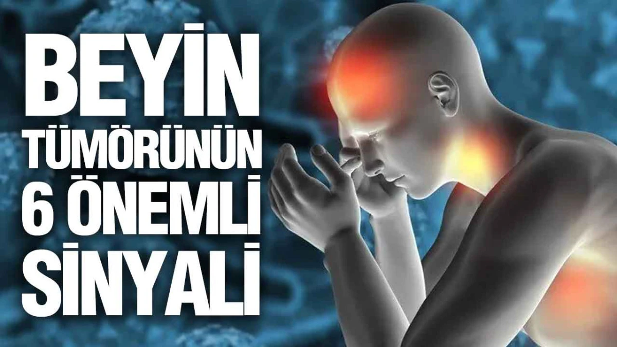 Beyin Tümörünün 6 Önemli Sinyali