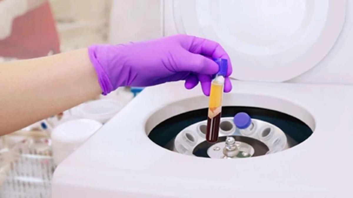 PRP Tedavisi: Vücudun Kendi Gücüyle Yenilenme Sanatı