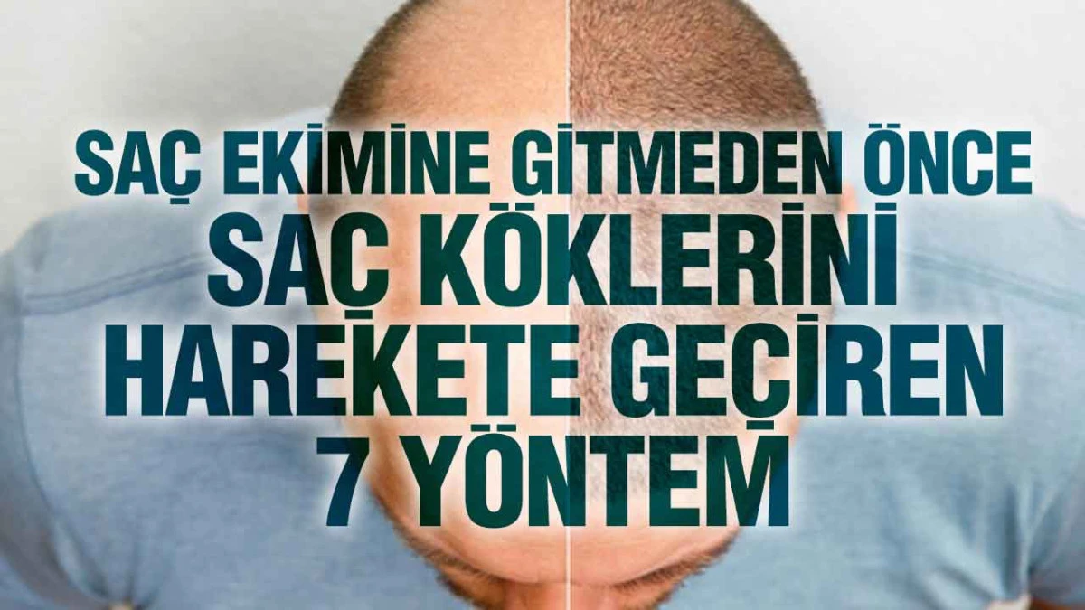 Saç Ekimine Gitmeden Önce; Saç Köklerini Harekete Geçiren 7 Yöntem